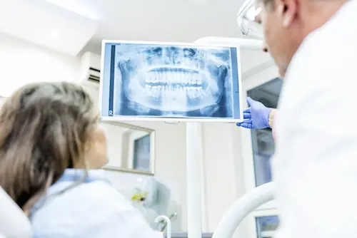 Digital Dental X-Rays available at C W Family Dentistry in West Covina, Ca
